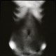 [AUKCJA] 1 | Judyta Bernaś | Błony pamięci 07 | druk pigmentowy | 50x50 cm | 2014 | 100,-
